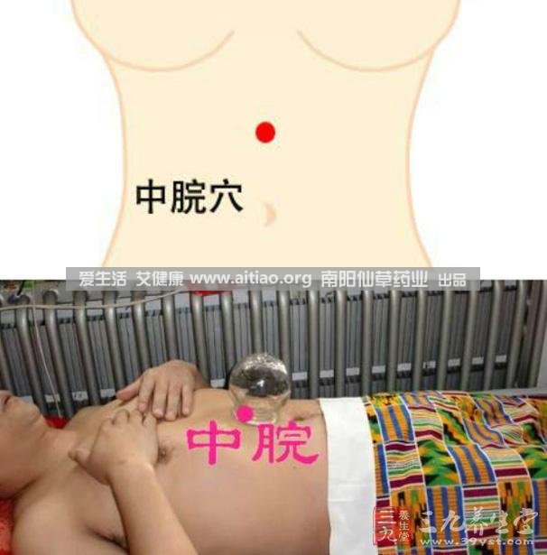 中脘穴位于腹部正中線，臍上4寸的位置上。每天艾灸10-15分鐘，能有效緩解胃部不適的癥狀，同時(shí)有助于祛濕。